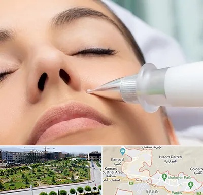 پلاسما جت بینی در پردیس