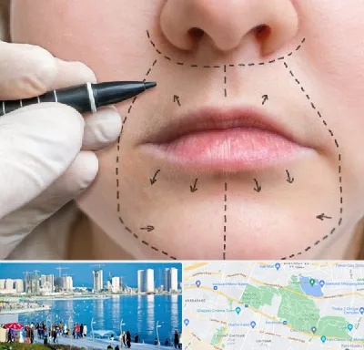 عمل سانترال لب در چیتگر 
