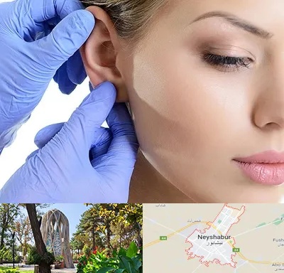 اتوپلاستی در نیشابور