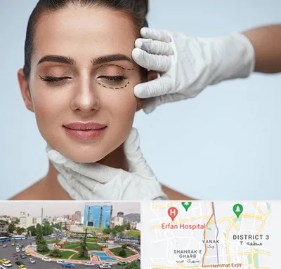 عمل پف چشم در ونک 