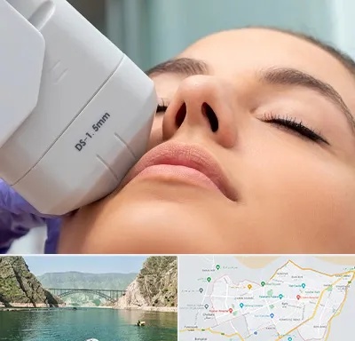 هایفوتراپی در ایلام