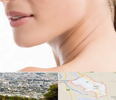 جراحی فک با لیزر در یاسوج