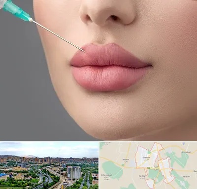 کلینیک ژل لب روسی در شهریار