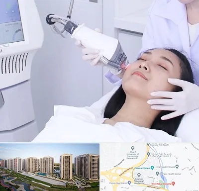 وایتنینگ در المپیک 