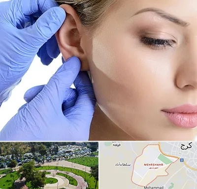 اتوپلاستی در مهرشهر کرج 