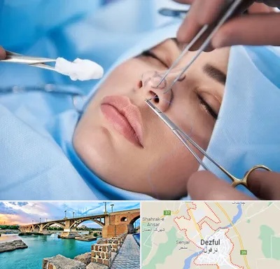 عمل ترمیمی بینی در دزفول