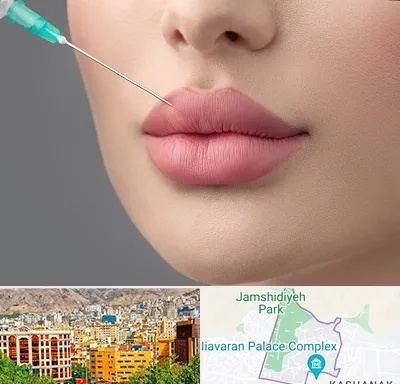 کلینیک ژل لب روسی در نیاوران 