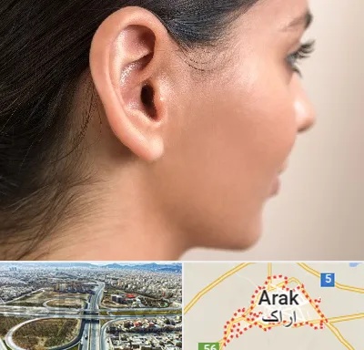 عمل گوش بل در اراک