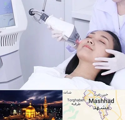 وایتنینگ در مشهد