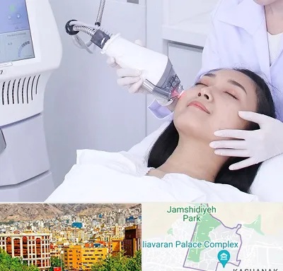 وایتنینگ در نیاوران 