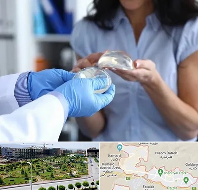 پروتز باسن در پردیس
