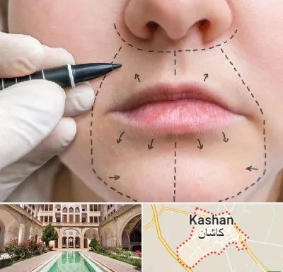 عمل سانترال لب در کاشان