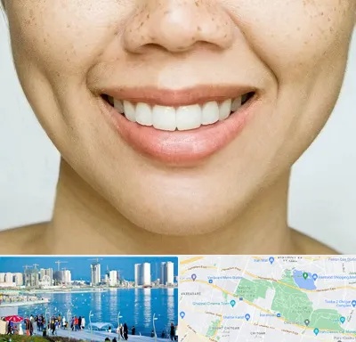 عمل چال گونه در چیتگر 