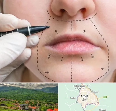 عمل سانترال لب در آمل