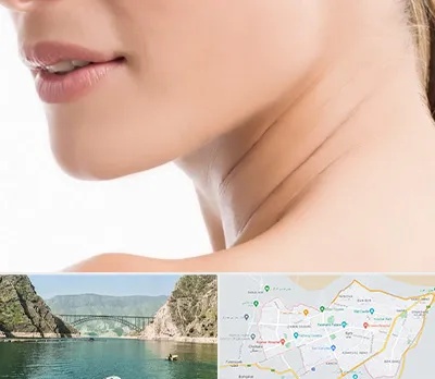 جراحی فک با لیزر در ایلام