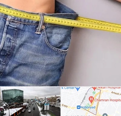 عمل لیپوماتیک در اقدسیه 