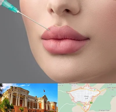 کلینیک ژل لب روسی در خوی