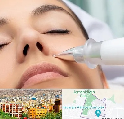 پلاسما جت بینی در نیاوران 
