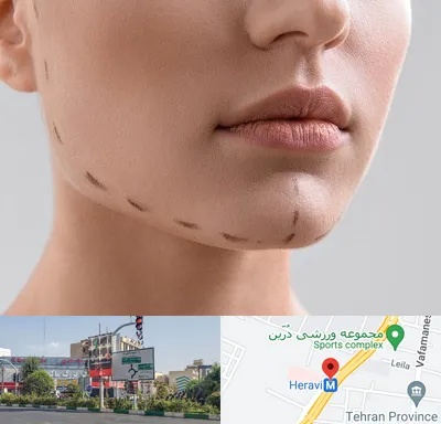 عمل زاویه فک در هروی 