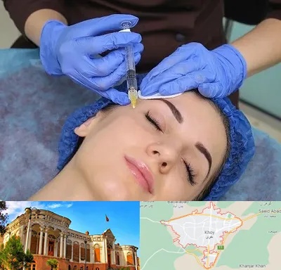تزریق پروفایلو در خوی
