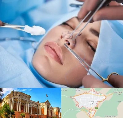 عمل ترمیمی بینی در خوی