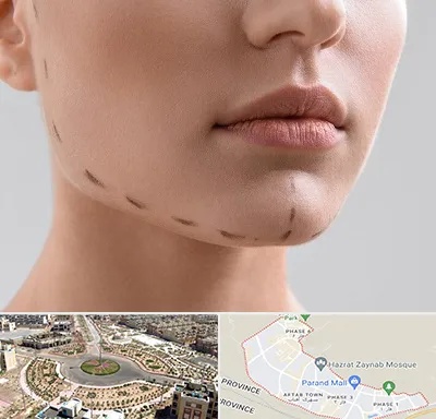 عمل زاویه فک در پرند
