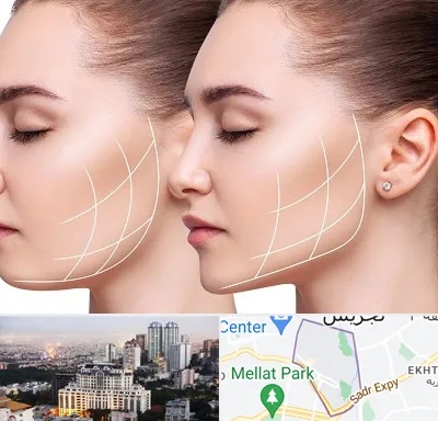 جراحی بوکال فت در الهیه 