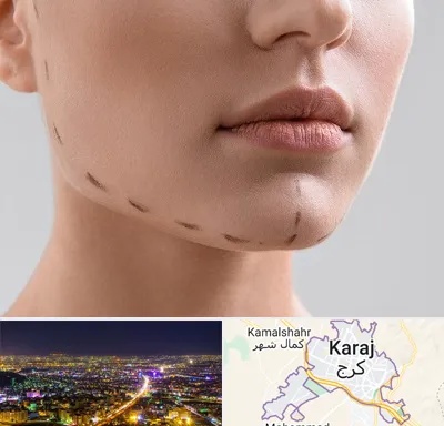 عمل زاویه فک در کرج