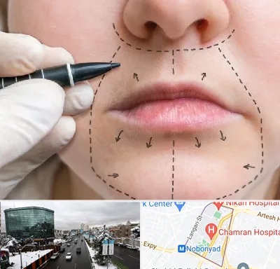 عمل سانترال لب در اقدسیه 