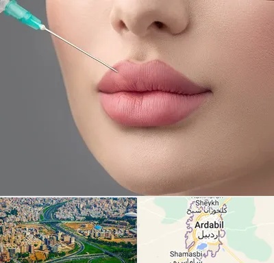 کلینیک ژل لب روسی در اردبیل