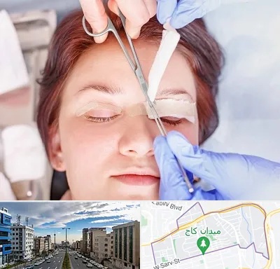 جراحی پلک افتاده در سعادت آباد 