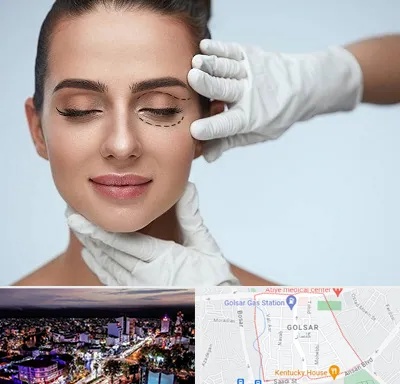 عمل پف چشم در گلسار رشت 
