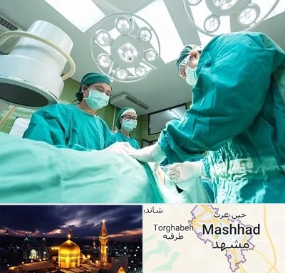 عمل تخلیه سینه در مشهد