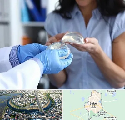 پروتز باسن در بابل