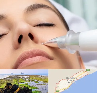 پلاسما جت بینی در بندرلنگه