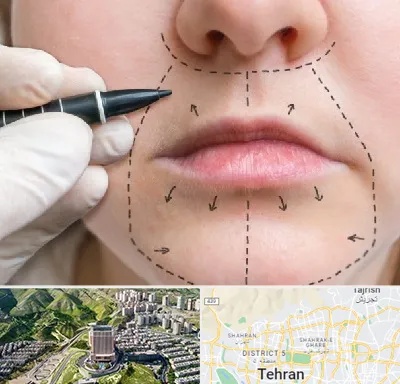 عمل سانترال لب در شمال تهران 