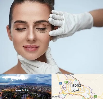 عمل پف چشم در تبریز
