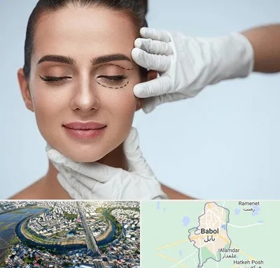عمل پف چشم در بابل
