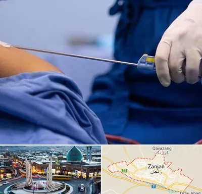 پیکر تراشی در زنجان