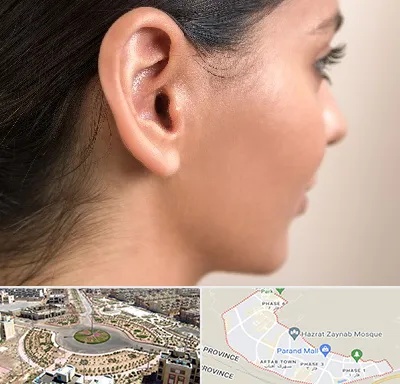 عمل گوش بل در پرند
