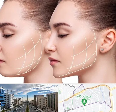 جراحی بوکال فت در سعادت آباد 
