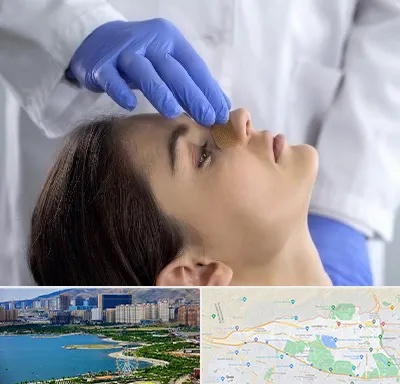 عمل بینی عروسکی در منطقه 22 تهران 
