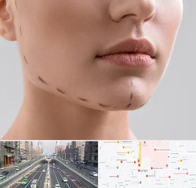 عمل زاویه فک در توحید 