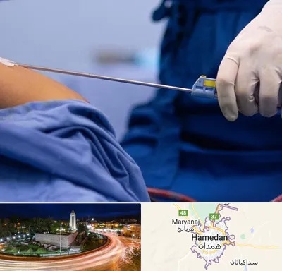 پیکر تراشی در همدان