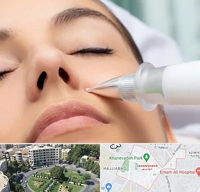 پلاسما جت بینی در جهانشهر کرج 