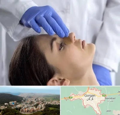 عمل بینی عروسکی در گرگان