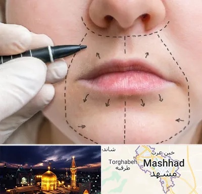 عمل سانترال لب در مشهد