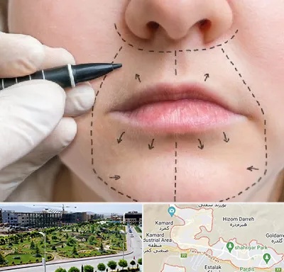 عمل سانترال لب در پردیس