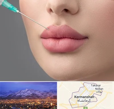 کلینیک ژل لب روسی در کرمانشاه