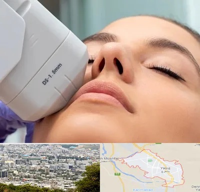 هایفوتراپی در یاسوج
